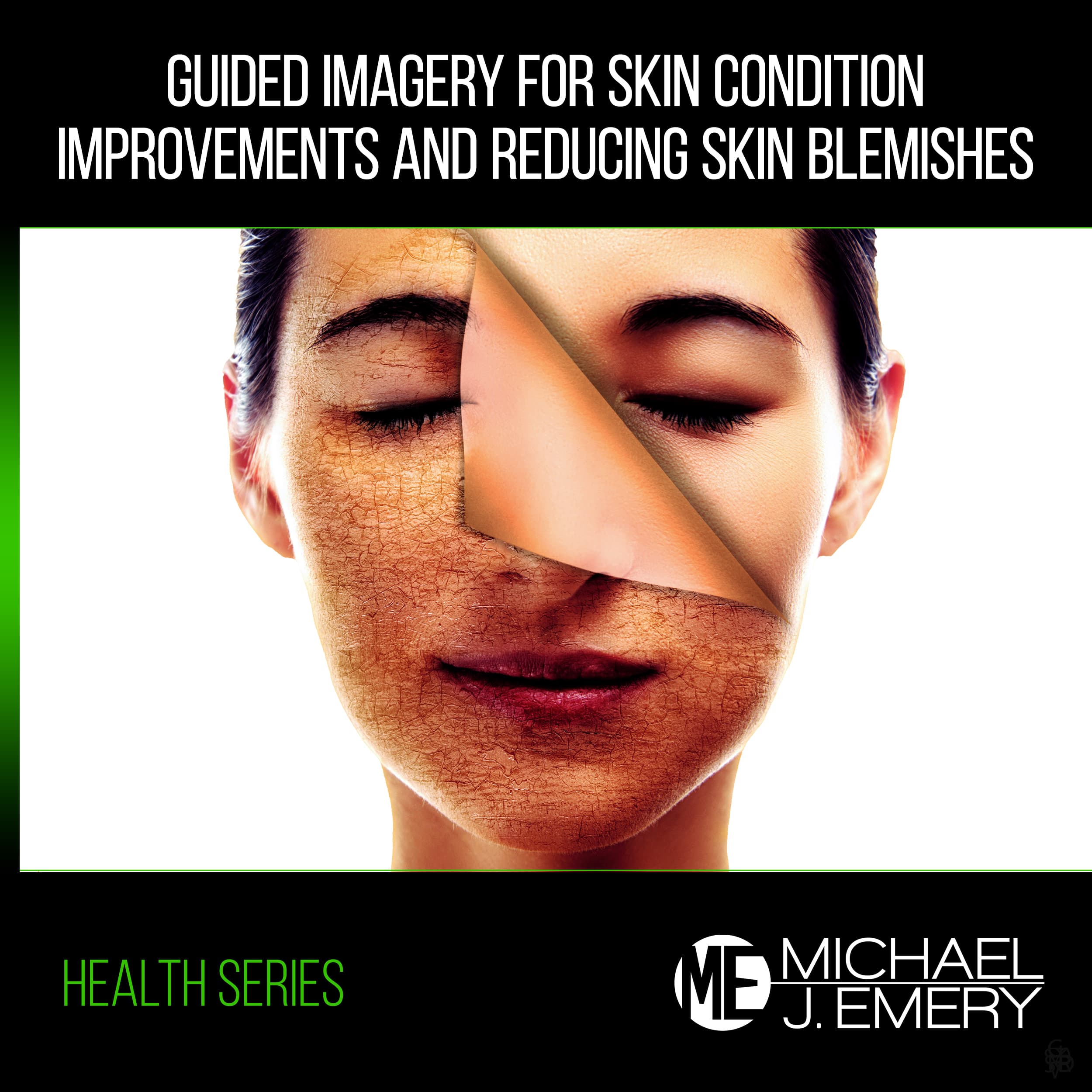 Guided-Imagery-for-Skin-Condition-Improvements-and-Reducing-Skin-Blemishes